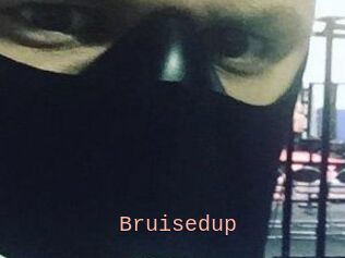 Bruisedup